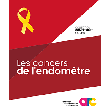 Image Cancers de l’endomètre : les bases d’une nouvelle piste thérapeutique