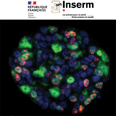 Image Cancer du sein : Offrir une médecine sur mesure grâce aux organoïdes